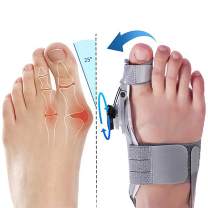 FlexiToe Bunion Corrector Brace